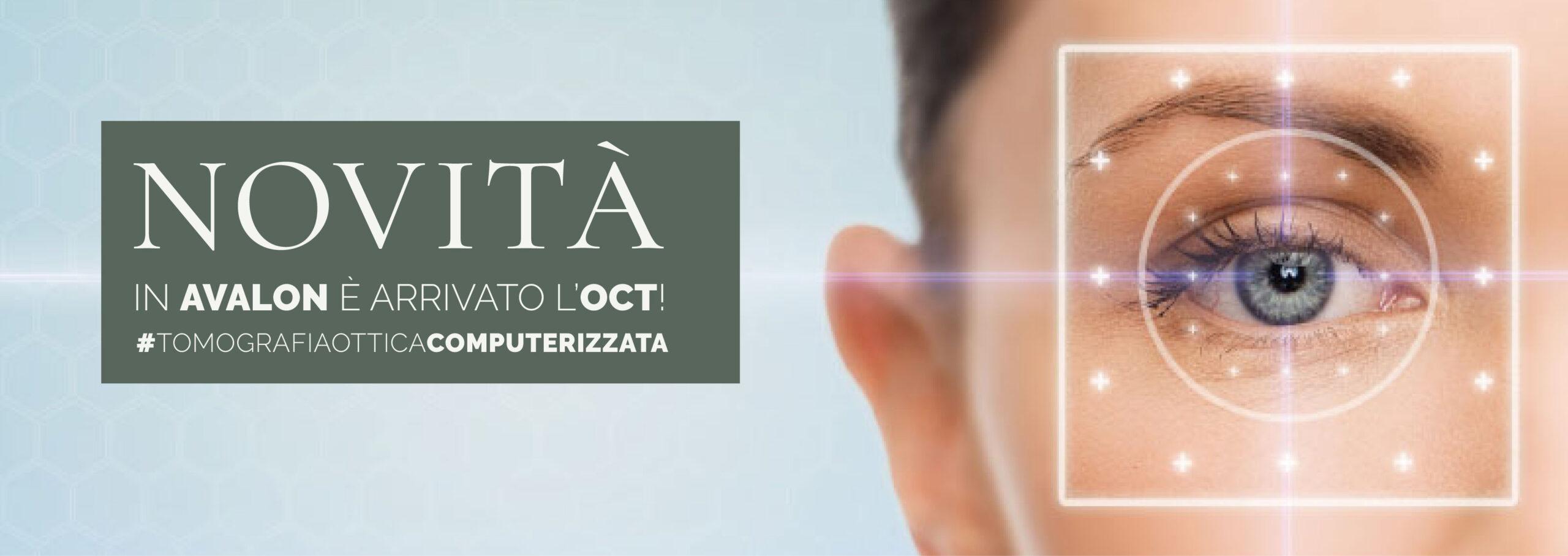 OCT, ADESSO ANCHE IN AVALON!