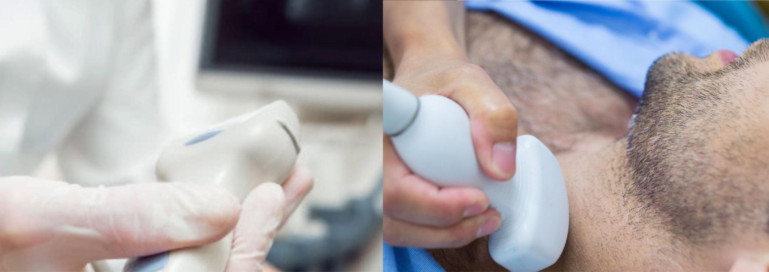 ECOCOLORDOPPLER: esame non invasivo!