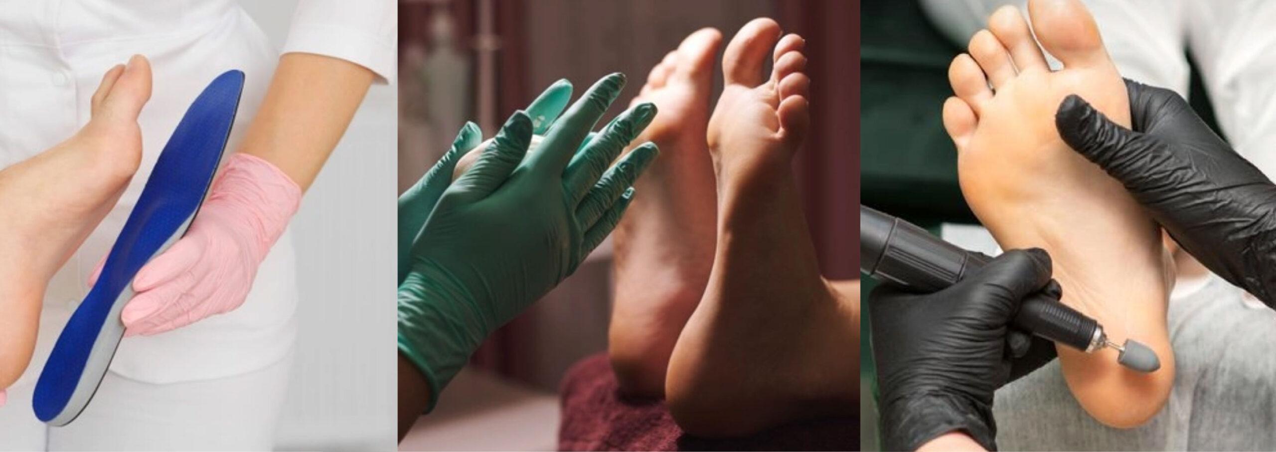 PODOLOGIA: tutti i trattamenti per i tuoi piedi