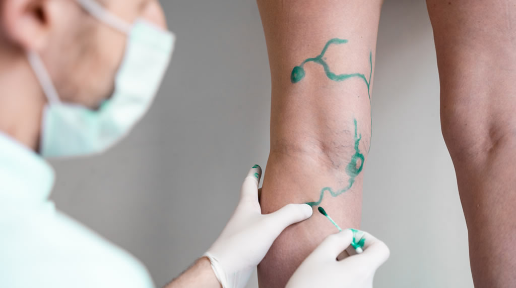 Visita Chirurgica Vascolare